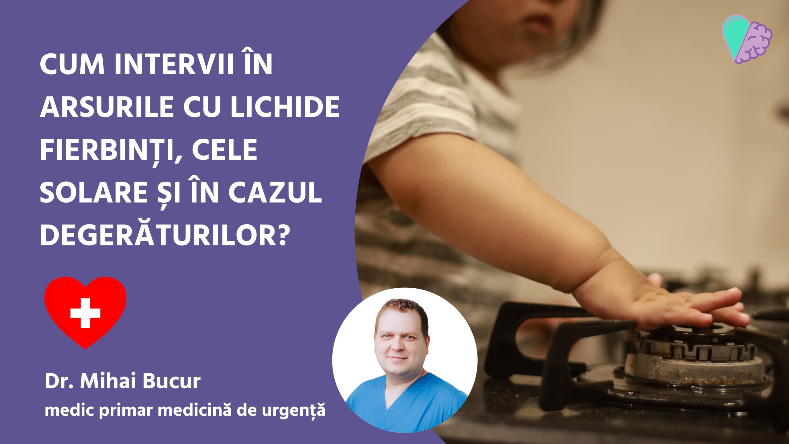 Cum intervii în arsurile cu lichide fierbinți, cele solare și în cazul degerăturilor?
