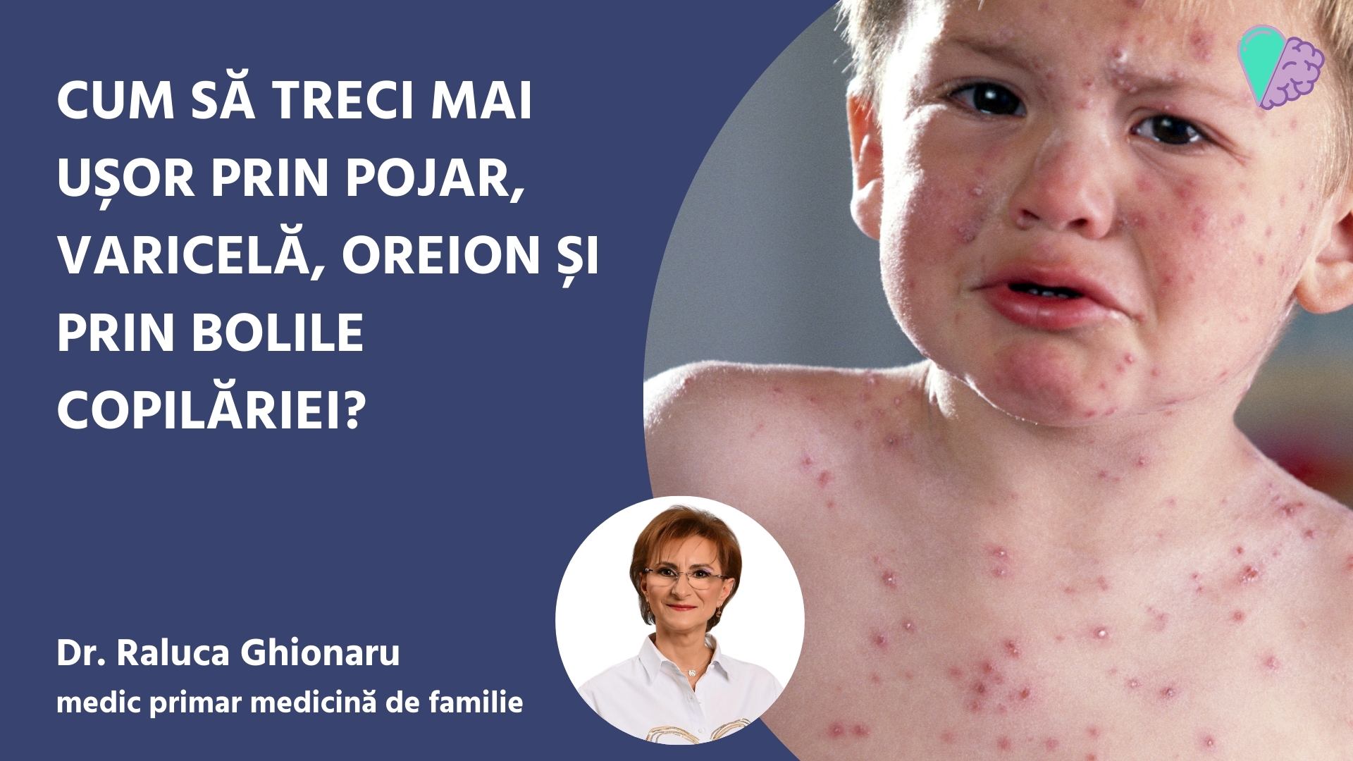 Cum să treci mai ușor prin pojar, varicelă, oreion și prin bolile copilăriei?